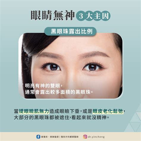 戴眼鏡眼鏡變小|整形外科 鄭穎醫師